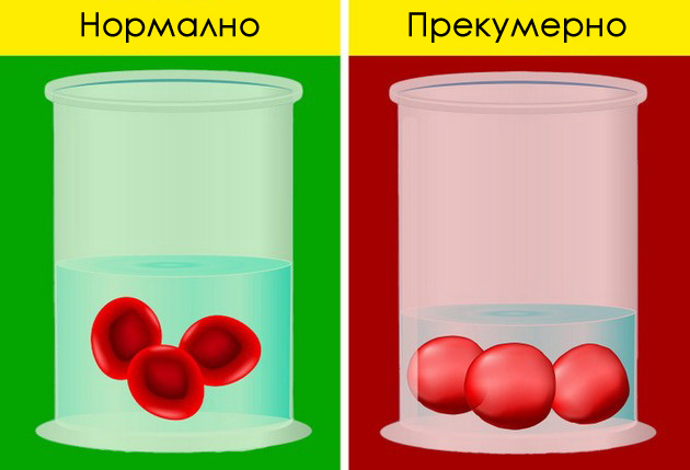 truenje-so-voda-glavobolka-shto-kje-se-sluchi-ako-preterate-so-pienje-voda-08.jpg