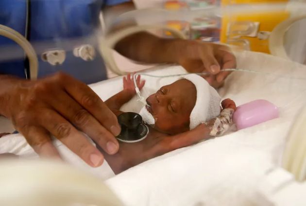 prvata-prezhiveana-devetorka-vo-svetot-se-vrati-doma-vo-mali-po-povekje-od-edna-godina-medicinska-nega-02 (1).jpg05.jpg