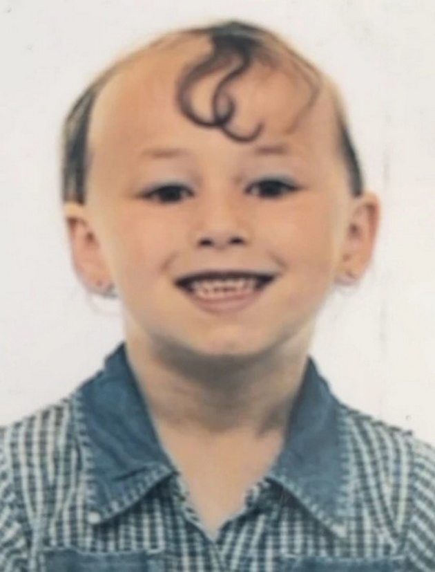 imam-alopecija-od-bebe-na-6-godini-ja-izbrichiv-glavata-a-na-14-gi-izgubiv-vegjite-i-trepkite-09.jpg