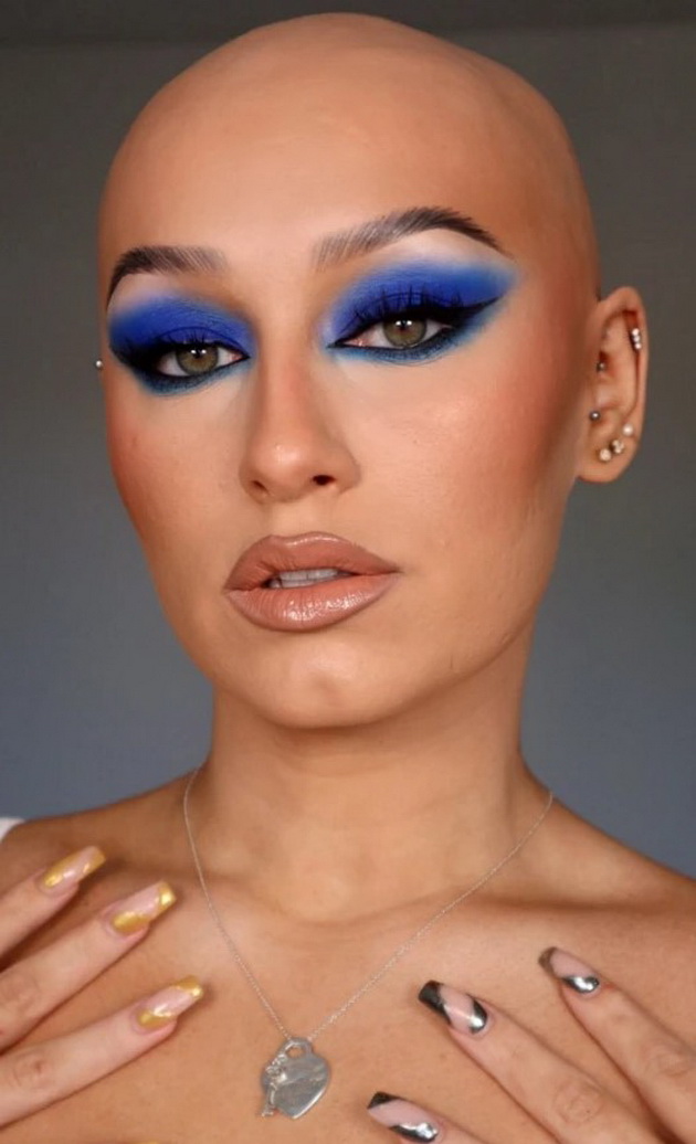 imam-alopecija-od-bebe-na-6-godini-ja-izbrichiv-glavata-a-na-14-gi-izgubiv-vegjite-i-trepkite-10.jpg
