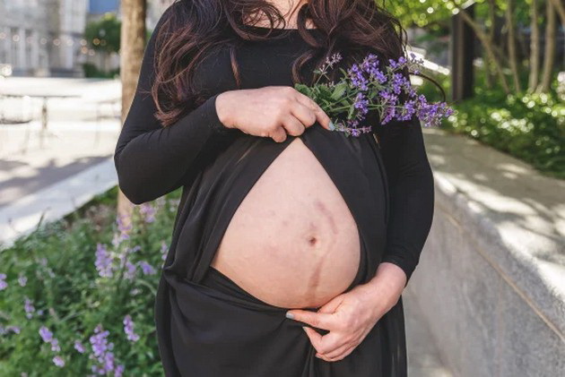 zhena-vtorpat-stana-majka-po-eksperimentalna-transplantacija-na-matka-od-zhiv-donor-08.jpg