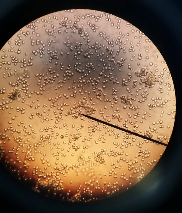13-foto-dokazi-kolku-chudno-izgledaat-obichnite-raboti-pod-mikroskop-06.jpg