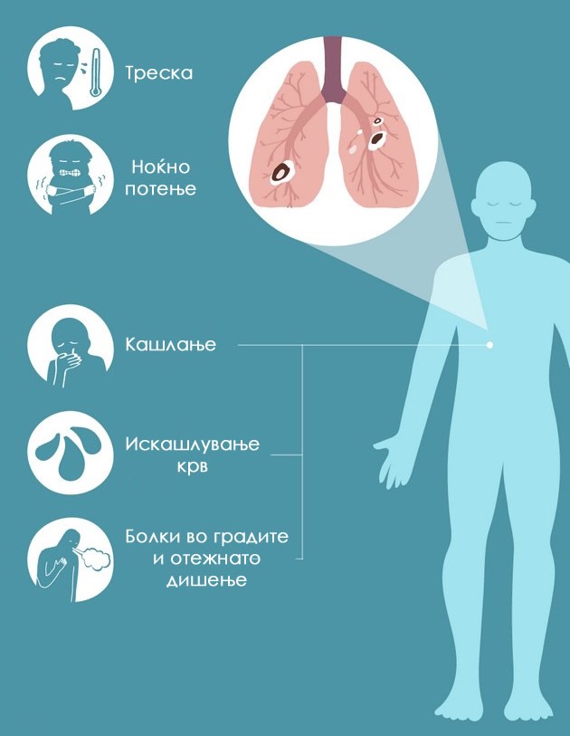 kolku-e-opasna-tuberkulozata-i-mozhete-li-da-se-zashtitite-03.jpg