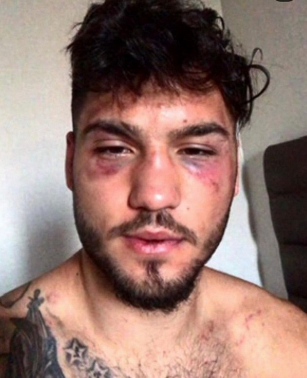 makedonski-profesionalen-bokser-gi-pokazhuva-povredite-po-natprevarite-ova-e-cenata-na-uspehot-04.jpg