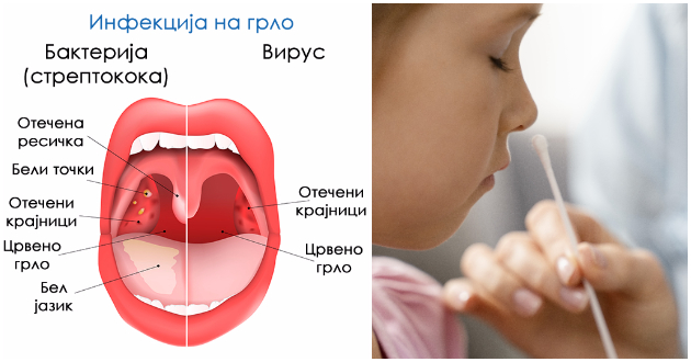 streptokoka-ili-virus-kako-da-prepoznaete-deka-na-vasheto-dete-itno-treba-da-go-odnesete-na-lekar-01.jpg