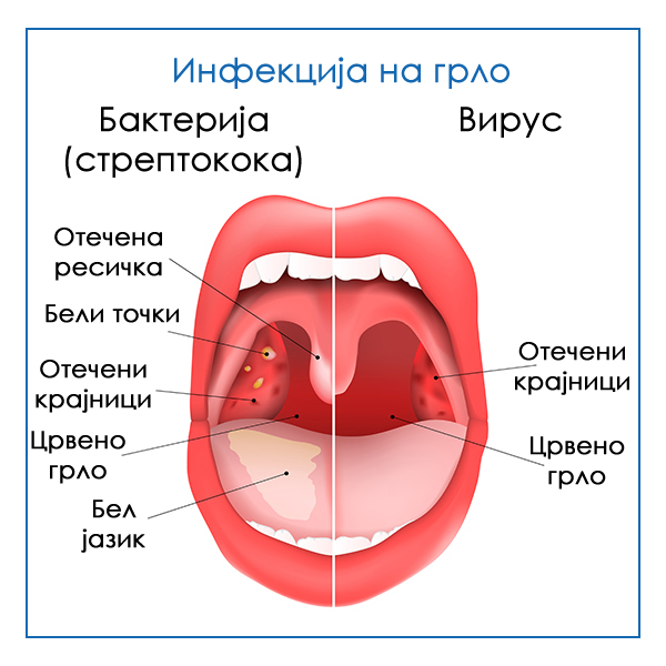 streptokoka-ili-virus-kako-da-prepoznaete-deka-na-vasheto-dete-itno-treba-da-go-odnesete-na-lekar-02_copy.jpg