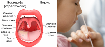 streptokoka-ili-virus-kako-da-prepoznaete-deka-na-vasheto-dete-itno-treba-da-go-odnesete-na-lekar-povekje-01.jpg