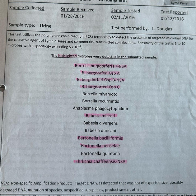 15-godini-strada-od-bolest-shto-se-prenesuva-od-zarazeni-krzhei-bela-hadid-pokazha-kako-izgleda-borbata-so-lajmskata-bolest-03.jpg