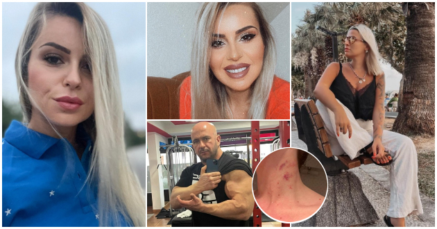 srbinka-gi-objavi-modrinkite-mia-kostova-so-zhestoka-osuda-reakcii-vo-regionot-otkako-mazh-vo-bosna-ja-ubi-nevenchanata-sopruga-pred-nivnoto-bebe-01.jpg