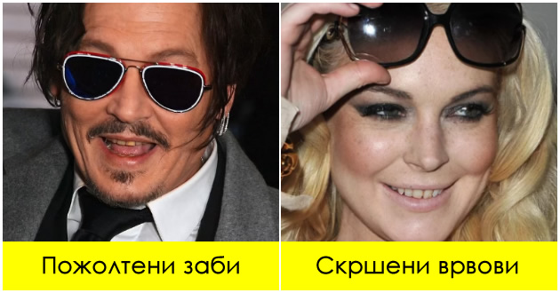 dzvezdi-koi-imaa-t-najloshi-zabi-vo-holivud-pozholtena-boja-potkrsheni-delovi-01.jpg