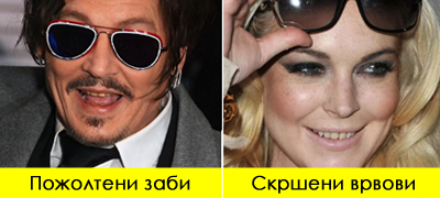 dzvezdi-koi-imaa-t-najloshi-zabi-vo-holivud-pozholtena-boja-potkrsheni-delovi-poveke-01.jpg