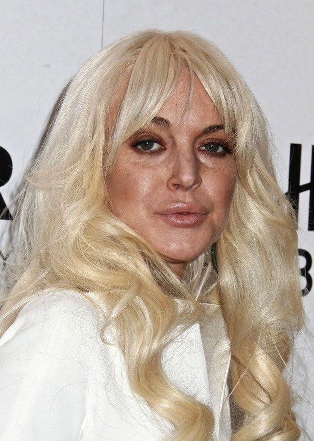 koja-e-srpskata-doktorka-shto-gi-izbrisha-godinite-i-tragite-od-droga-na-liceto-na-lindzi-lohan-40-02.jpg