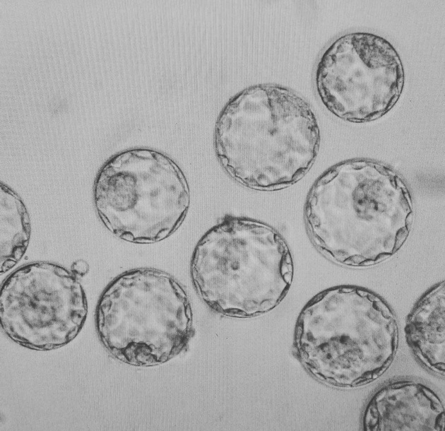 d-r-valentina-sotiroska-embriolog-zhenite-nad-40-godini-imaat-8-shansa-da-zabremenat-so-in-vitro-02.jpg