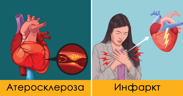 koi-se-najchestite-problemi-so-srceto-i-mozhe-li-da-gi-sprechite-01.jpg