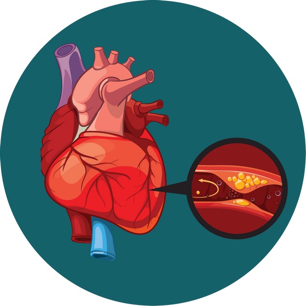 koi-se-najchestite-problemi-so-srceto-i-mozhe-li-da-gi-sprechite-03.JPG