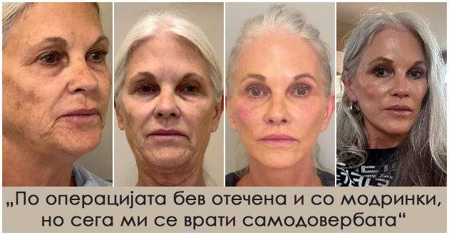 od-obichen-izgled-do-holivudski-sjaj-66-godishna-zhena-neprepoznatliva-po-6-chasovna-plastichna-operacija-01.jpg