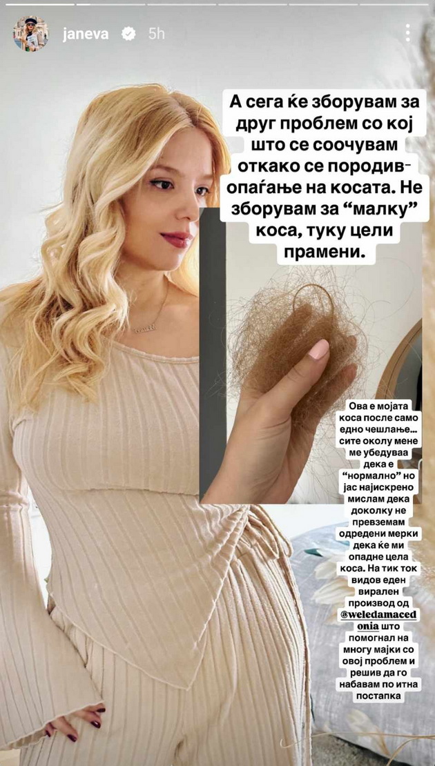 sofija-janeva-otkako-se-porodiv-se-soochuvam-so-opagjanje-na-kosata-zboruvam-za-celi-prameni-03.jpg