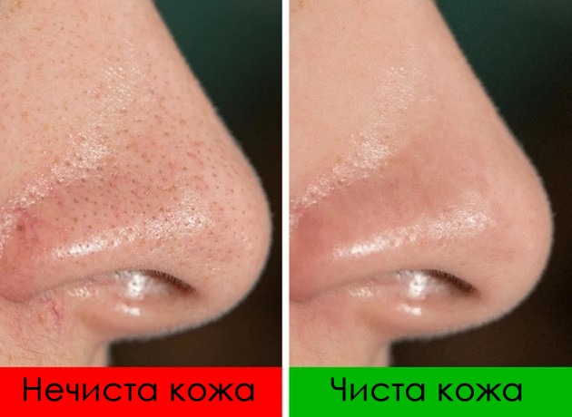8-mitovi-za-ubavina-so-koi-shtetite-na-kozhata-i-nepotrebno-troshite-pari-07.jpg