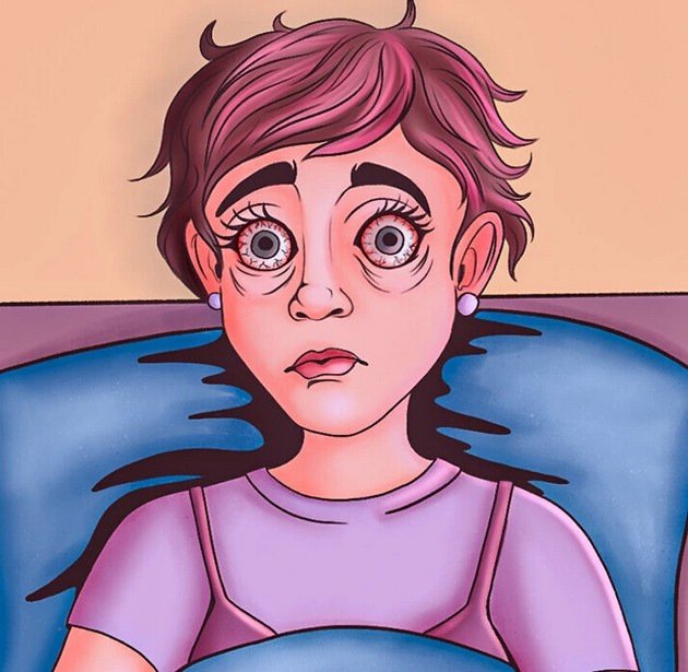 neobichni-i-neochekuvani-simptomi-so-koi-mozhe-da-se-soochite-vo-menopauza-09.JPG