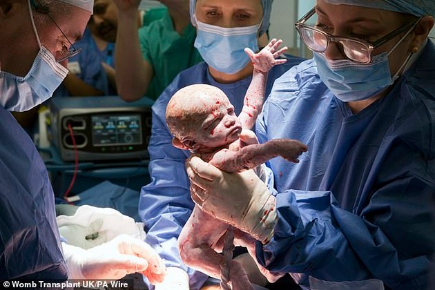 rodiv-dete-so-transplantirana-matka-po-17-godini-neplodnost-sestra-mi-beshe-donor-02.JPG