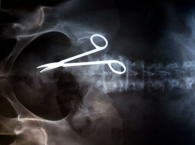 sindrom-na-zhiv-mrtovec-i-ushte-11-chudni-medicinski-sluchai-so-koi-se-soochile-lekarite-02_copy.JPG