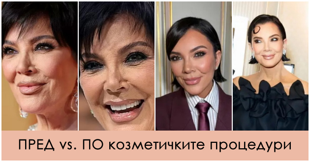 koj-e-plastichniot-hirurg-shto-go-preraboti-liceto-na-kris-djenes-i-i-gi-izbrisha-tragite-od-stareenjeto-01.jpg