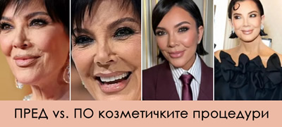 koj-e-plastichniot-hirurg-shto-go-preraboti-liceto-na-kris-djenes-i-i-gi-izbrisha-tragite-od-stareenjeto-povekje01.jpg