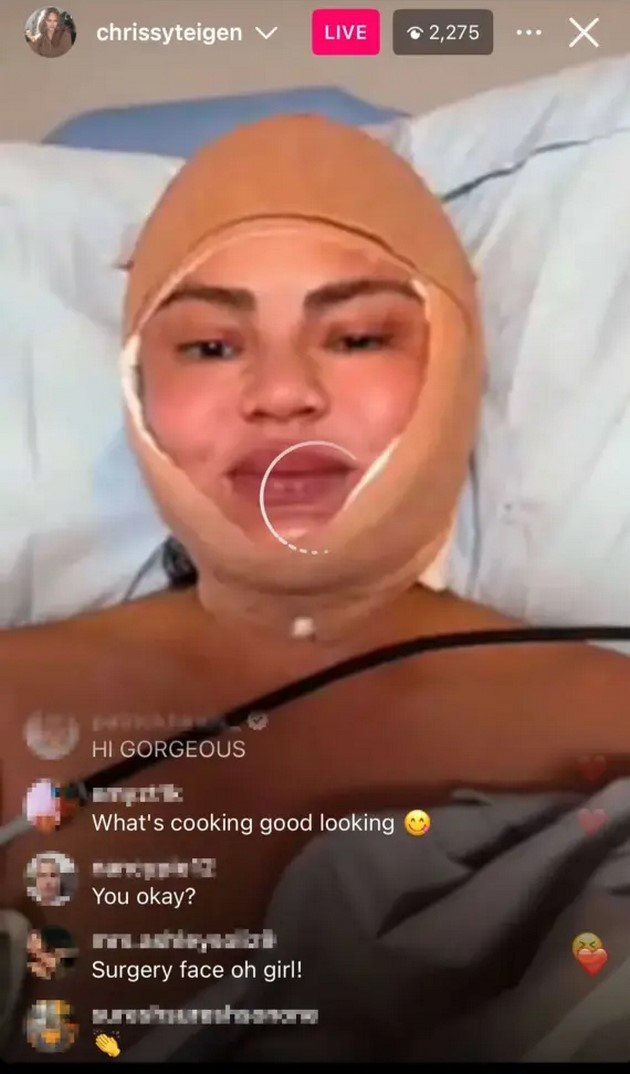 gi-izvadi-implantite-pa-napravi-operacija-za-namaluvanje-na-cheloto-krisi-tajgen-e-opsednata-so-kozmetichki-korekcii-08_copy.JPG