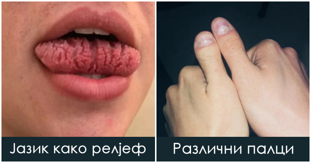 15-foto-dokazi-deka-genetikata-mozhe-da-ne-iznenadi-na-najneobichni-nachini-01.jpg