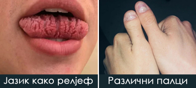 15-foto-dokazi-deka-genetikata-mozhe-da-ne-iznenadi-na-najneobichni-nachini-poveke-01.jpg