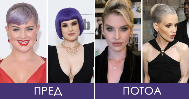 keli-ozborn-izgleda-kako-druga-lichnost-otkako-oslabe-negira-deka-pravela-operacii-ili-deka-koristi-ozempik-01.jpg