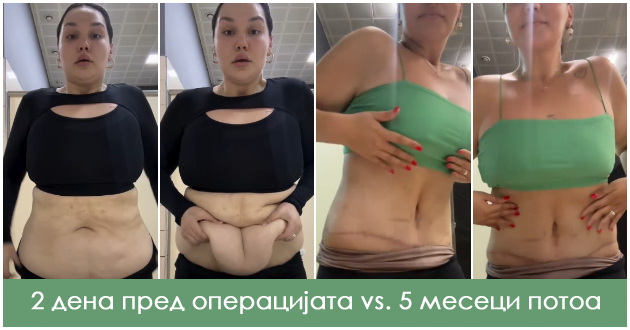 ivona-jo-go-pokazha-ramniot-stomak-a-za-crnobelo-veli-gordo-gi-nosam-luznite-vnimavam-na-ishranata-02.fw.jpg