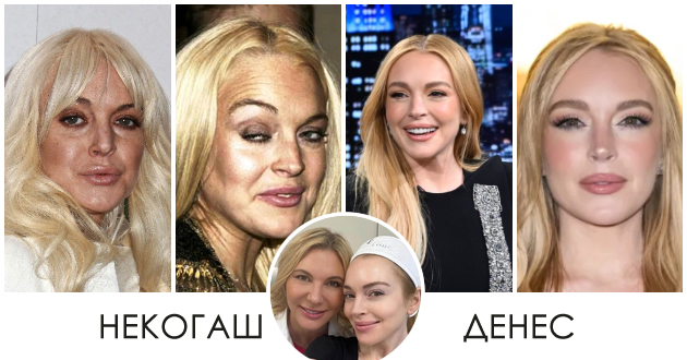lindzi-lohan-bleska-pokraj-soprugot-na-nastan-otkako-gi-izbrisha-tragite-od-poroci-na-liceto-foto.jpg