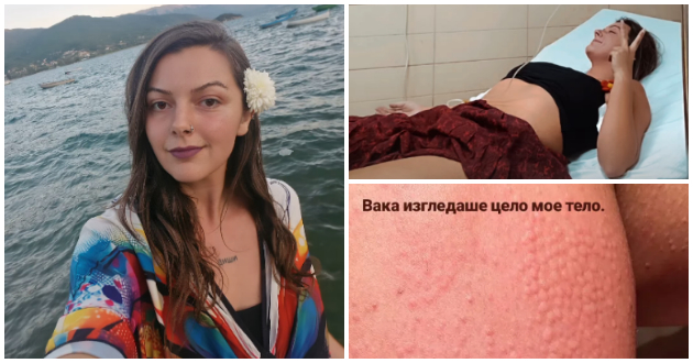 ledenata-makedonka-betika-spodeli-strashno-iskustvo-i-fotki-od-bolnica-zgaznav-na-strshlen-izbegnav-sigurna-smrt01.jpg