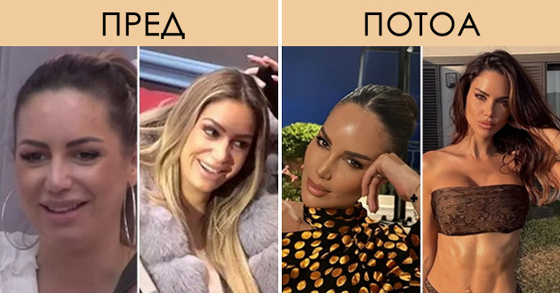 rijaliti-dzvezda-od-hrvatska-e-neprepoznatliva-pred-i-po-plastichnite-operacii-foto-01.jpg
