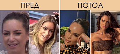 rijaliti-dzvezda-od-hrvatska-e-neprepoznatliva-pred-i-po-plastichnite-operacii-foto-01povekje.jpg