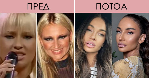 srpska-pejachka-e-neprepoznatliva-pred-i-po-plastichnite-operacii-foto-01.jpg