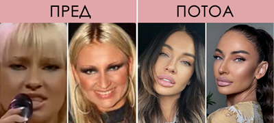 srpska-pejachka-e-neprepoznatliva-pred-i-po-plastichnite-operacii-foto-01povekje.jpg
