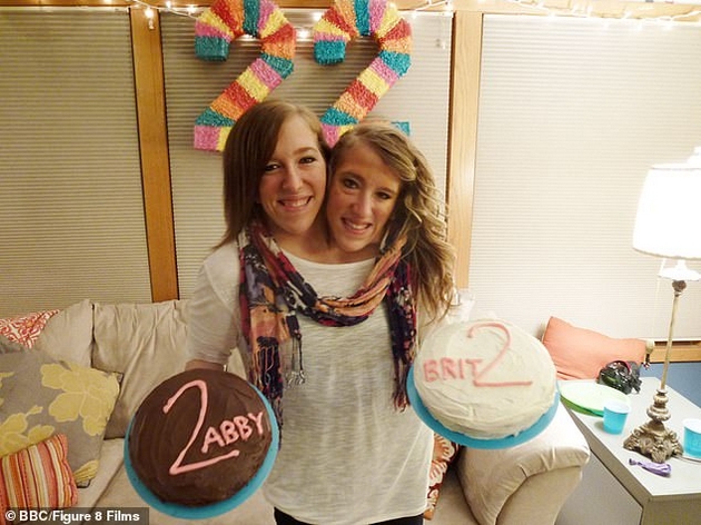najpoznatite-sijamski-bliznachki-vo-svetot-fotografirani-so-bebe-po-glasinite-za-bremenost-mozhat-li-da-dobijat-bioloshko-dete-05.JPG