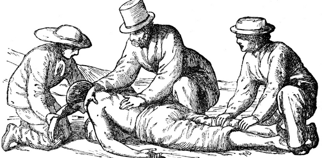 rerna-za-lugje-lobotomija-lekovi-so-kokain-medicinata-vo-minatoto-bila-kako-od-horor-film-05.JPG