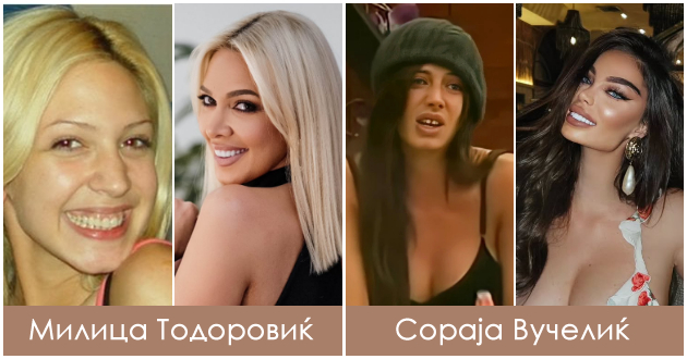 koi-regionalni-dzvezdi-imaat-nasmevka-od-milion-dolari-po-korekcijata-na-zabite-01.jpg