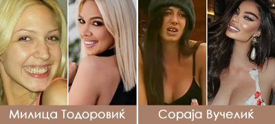 koi-regionalni-dzvezdi-imaat-nasmevka-od-milion-dolari-po-korekcijata-na-zabite-poveke-01.jpg
