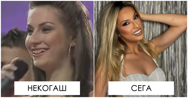 tvrdi-deka-ne-go-operirala-nosot-ja-zgolemi-ustata-kolku-se-smeni-rada-manojlovikj-od-pochetokot-na-karierata-01.jpg