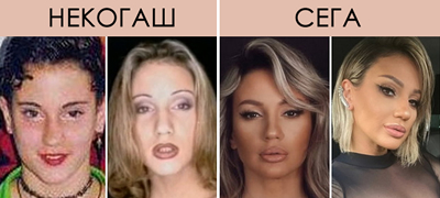 drastichnata-transformacija-na-pejachkata-ana-kokikj-42-poinakov-nos-vegji-01povekje.jpg