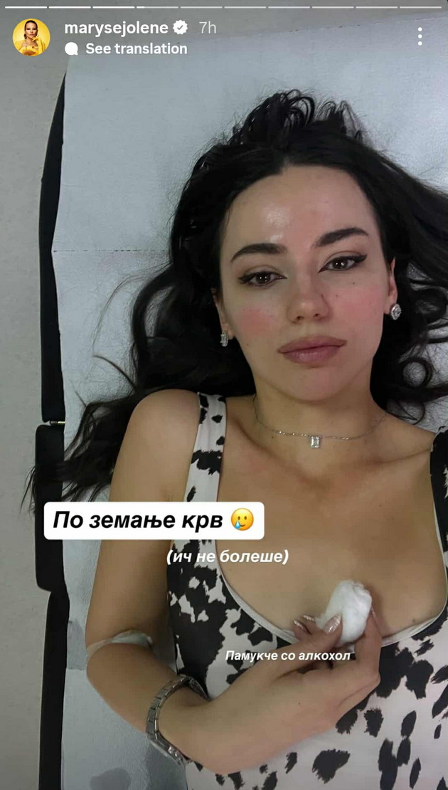 maris-po-estetskata-korekcija-na-uvoto-javno-zboruva-i-za-ispituvanjata-za-hashimoto-vo-shvedska-e-poinaku-05.jpg