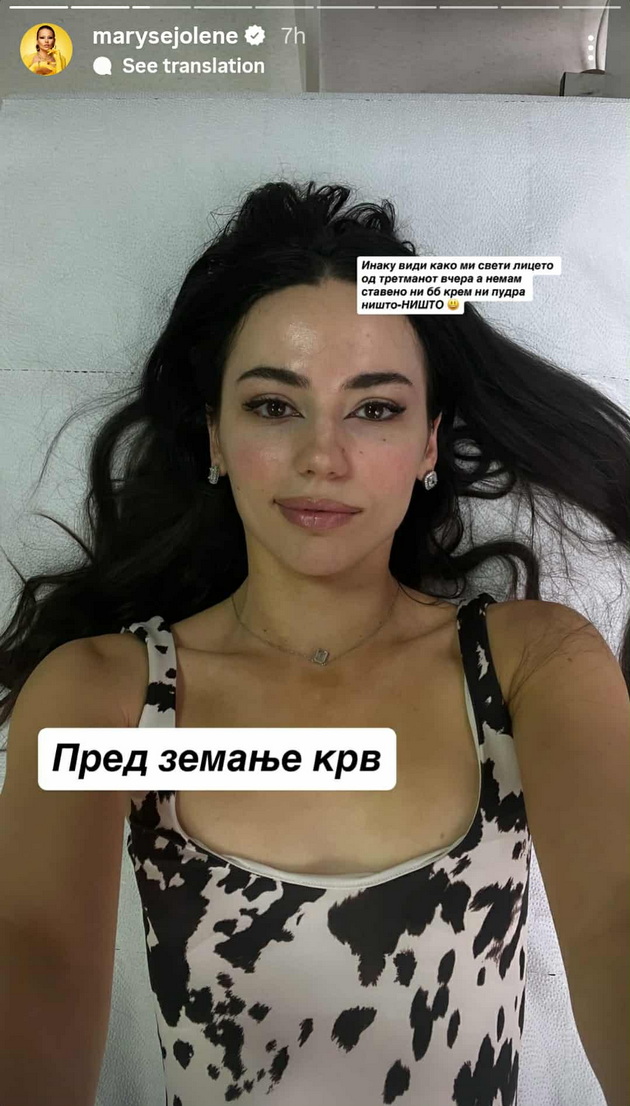 maris-po-estetskata-korekcija-na-uvoto-javno-zboruva-i-za-ispituvanjata-za-hashimoto-vo-shvedska-e-poinaku-06.jpg