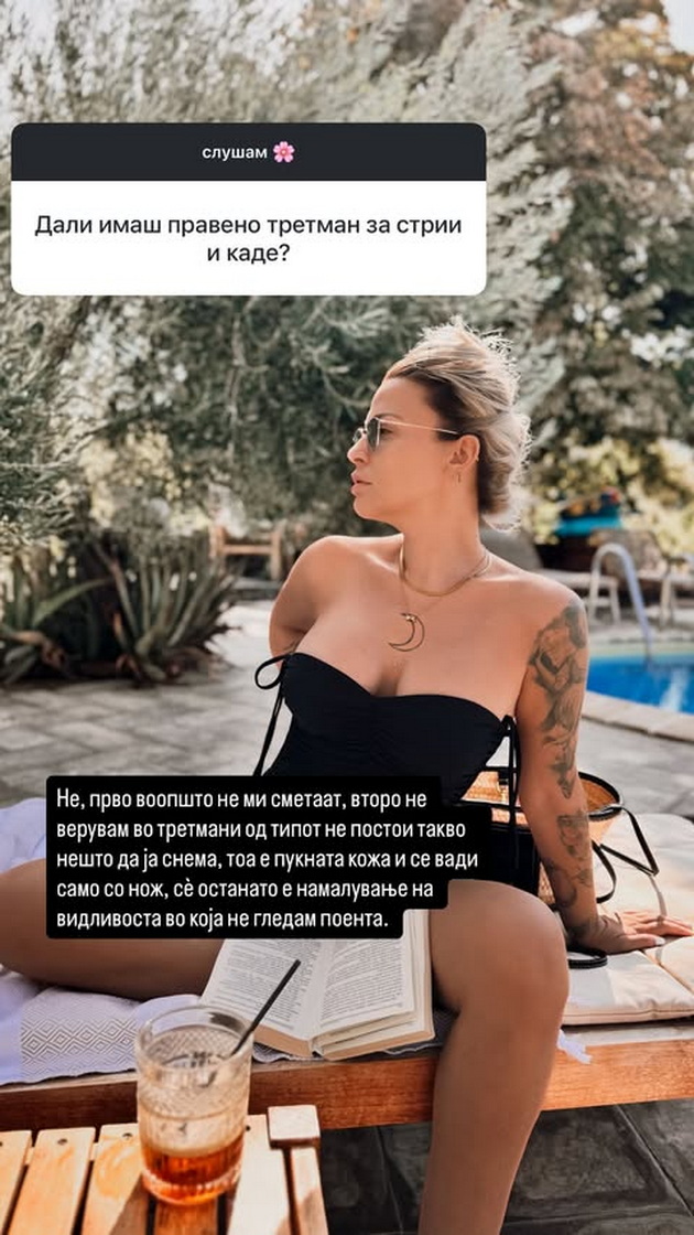 mia-kostova-prvpat-staviv-botoks-na-29-godini-ne-se-bockajte-po-neprovereni-salonchinja-07.jpg