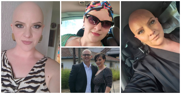 kristina-andova-za-bitkata-so-alopecija-nikogash-nema-da-nosam-marami-sega-koga-ja-znam-slobodata-bez-niv-01.jpg