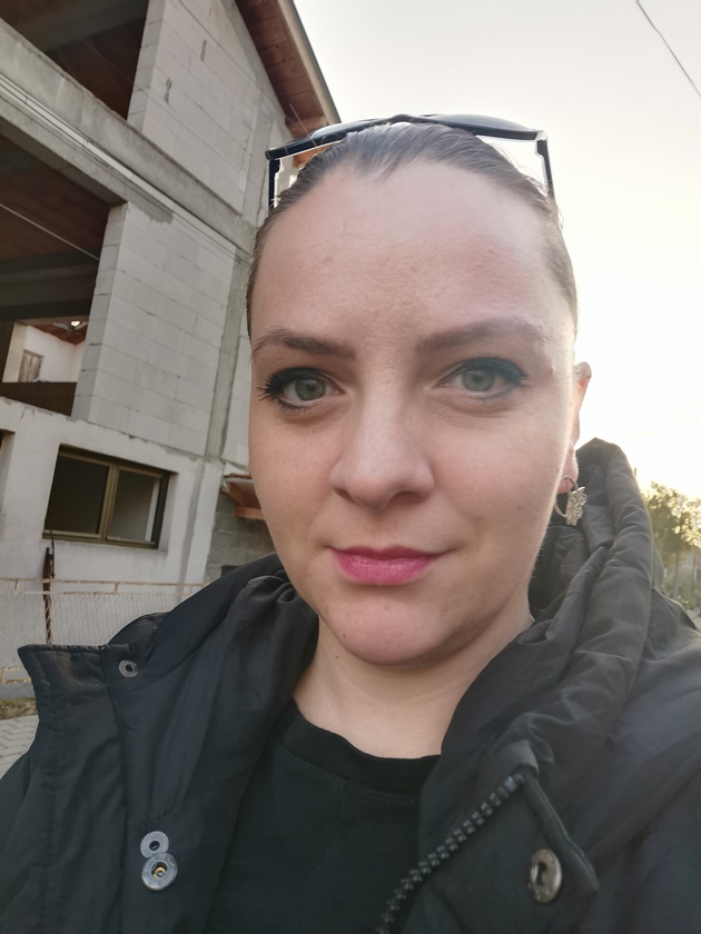 kristina-andova-za-bitkata-so-alopecija-nikogash-nema-da-nosam-marami-sega-koga-ja-znam-slobodata-bez-niv-02.JPG