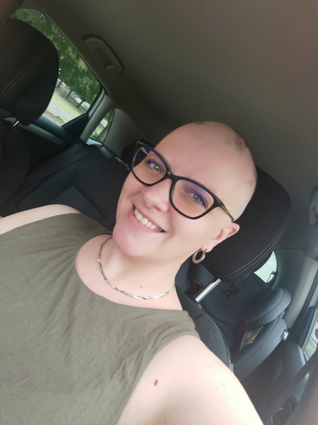 kristina-andova-za-bitkata-so-alopecija-nikogash-nema-da-nosam-marami-sega-koga-ja-znam-slobodata-bez-niv-07.JPG